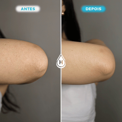 Loção Hidratante Corporal 200ml Oferta Especial